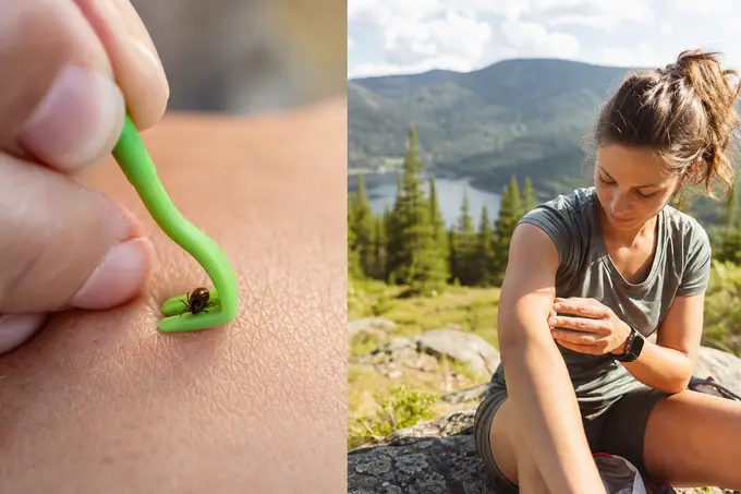 Comment bien retirer une tique, et combien de temps surveiller la zone avant de s'inquiéter d'une maladie de Lyme ?