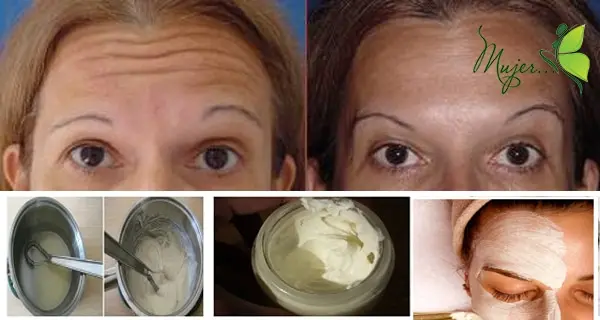 Crème anti-rides dermatologues : comment choisir la meilleure ?